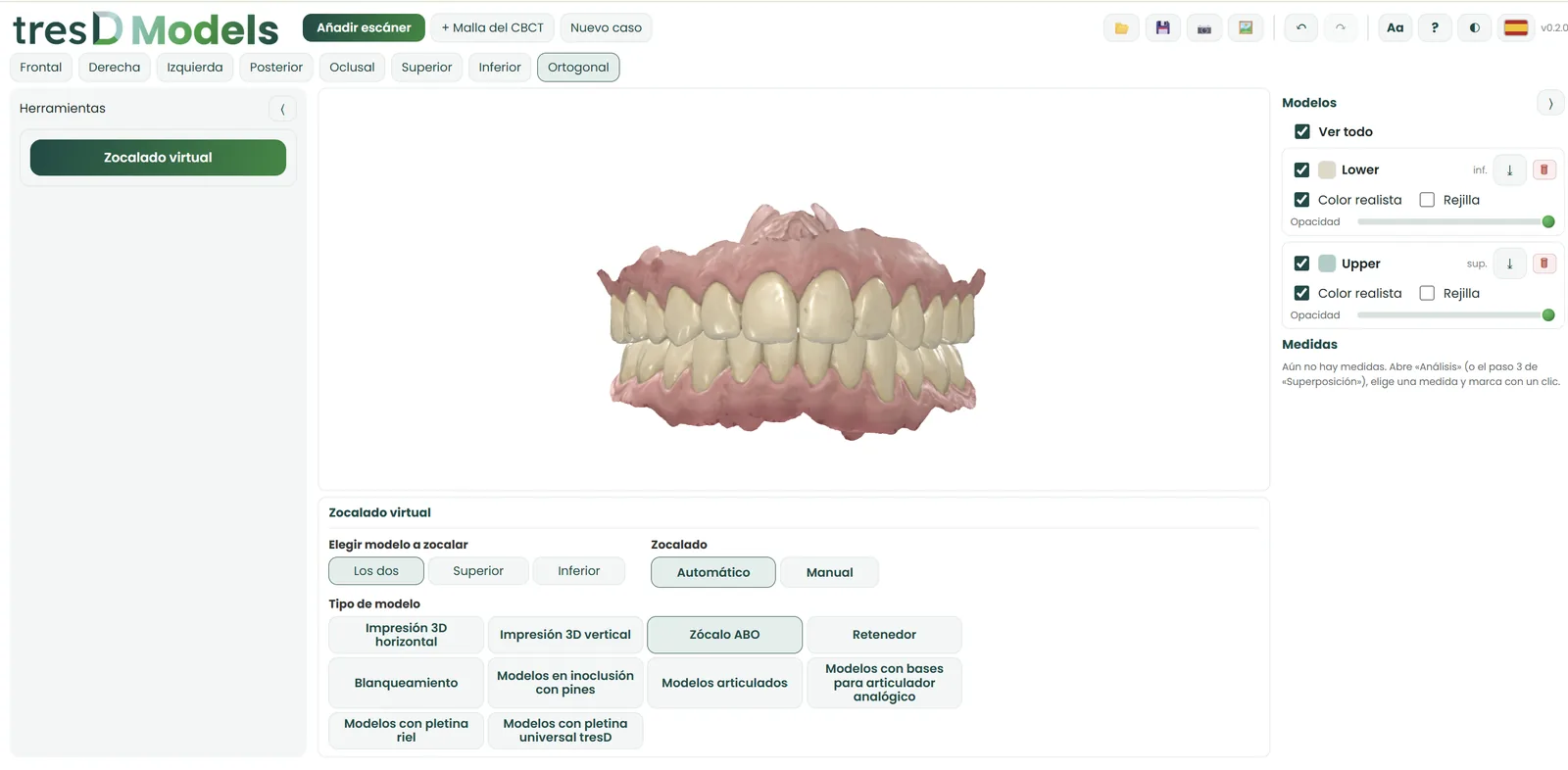 Interfaz de tresD Models con el zocalado virtual de dos arcadas